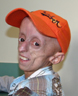Progeria Triple Drug Trial Fully Enrolled!