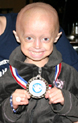 First-Ever Progeria Clinical Drug Trial Surpasses Half-Way Mark!