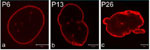 Progeria Cells