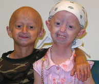 <B>July 20, 2011 in Bookstores: </B>“The Lost Fountain”, a children’s fictional story about Progeria, is published, with 50% of proceeds to be donated to PRF.